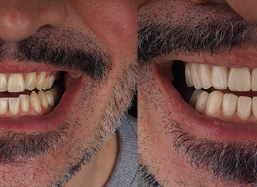 Dental Treatments | Noyan Health & Travel | Turkey Health Tourism