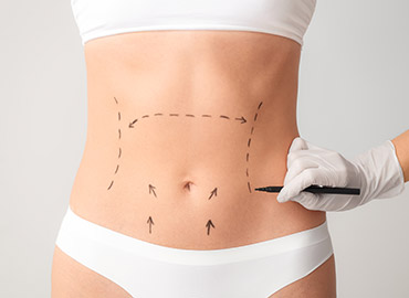 Special Offers | Mini and X Large Tummy Tuck | Noyan Health and Travel