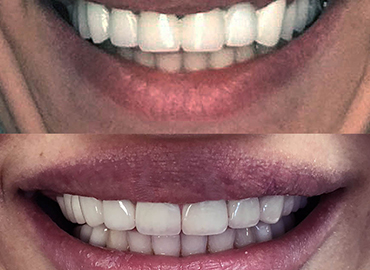 Noyan Health & Travel | Dental Treatments | 9