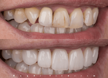 Noyan Health & Travel | Dental Treatments | 21