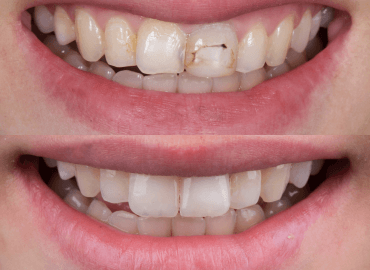 Noyan Health & Travel | Dental Treatments | 25