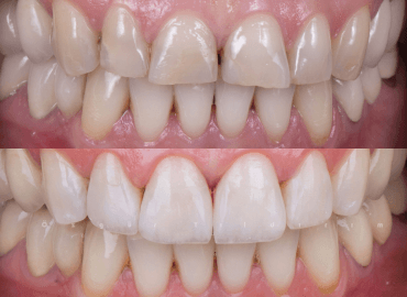 Noyan Health & Travel | Dental Treatments | 23