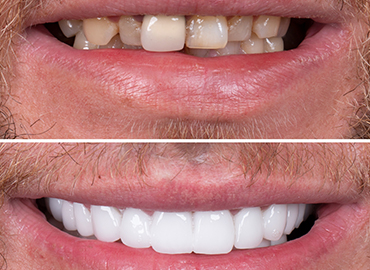 Noyan Health & Travel | Dental Treatments | 10