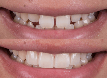 Noyan Health & Travel | Dental Treatments | 27