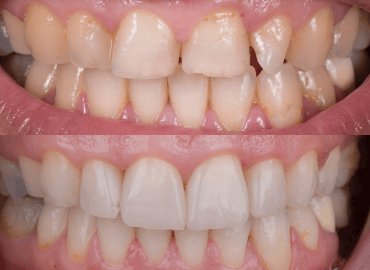 Noyan Health & Travel | Dental Treatments | 16