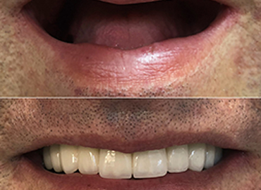 Noyan Health & Travel | Dental Treatments | 5