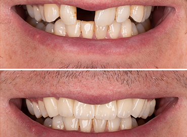 Noyan Health & Travel | Dental Treatments