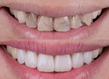 Noyan Health & Travel | Dental Treatments | 18